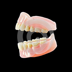 Complete Dentures photo