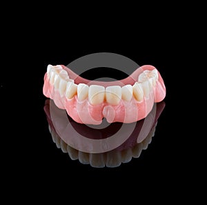Complete maxillary denture