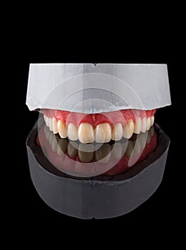 Complete maxillary denture Ã¢â¬â Wax-Up and Gingival Contouring
