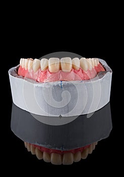 Complete maxillary denture Ã¢â¬â Wax-Up and Gingival Contouring