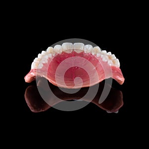 Complete maxillary denture â€“ Wax-Up and Gingival Contouring