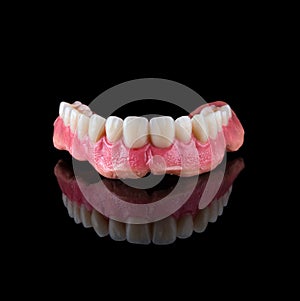 Complete maxillary denture â€“ Wax-Up and Gingival Contouring