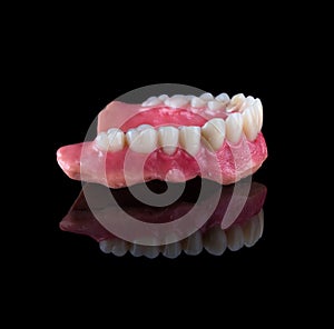 Complete maxillary denture â€“ Wax-Up and Gingival Contouring