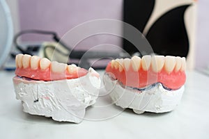 Complete removable dental prostheses on gypsum models