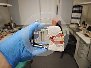 complete removable dental prostheses on gypsum models