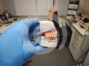 complete removable dental prostheses on gypsum models