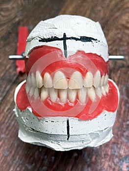 Complete removable dental prostheses on gypsum models. Natural full prosthesis made of quality materials in plaster