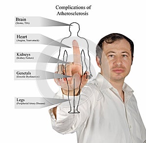 Complications of Atherosclerosis