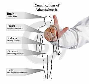 Complications of Atherosclerosis