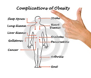 Complications of Obesity