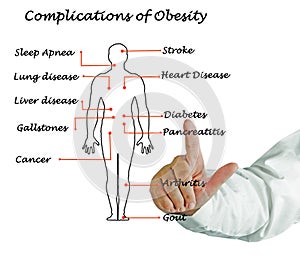 Complications of Obesity photo