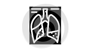 complications or pneumonia glyph icon animation