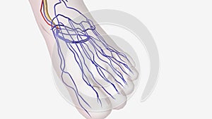 Complications of Type 2 Diabetes, Pain numbnes