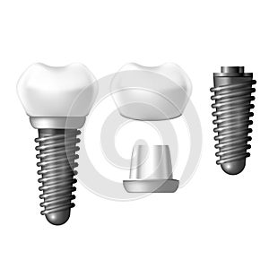 Component parts of dental implant - teeth denture