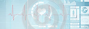 Composite image of digitally generated image of electrocardiography 3d