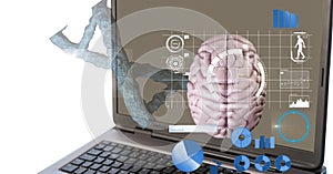 Composition of human brain and medical data processing over laptop computer