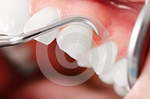 Comprehensive dental examination