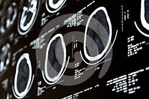 Computed Tomography CT photo