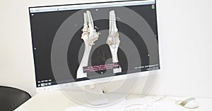 Computed tomography of the dog. A CT scan of a dog with complaints of pain in the leg was performed. Computed tomography