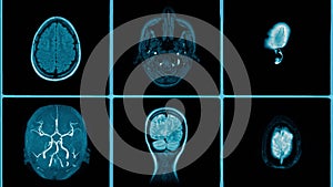 Computed tomography scans against dark background loop footage