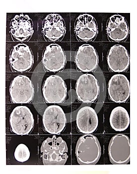 Computer Aided Tomography