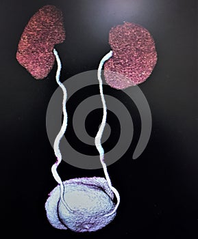 Computer tomography 3d imaging urology