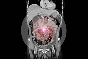 Computer tomography scan technology in surgical patient with abdominal pain.