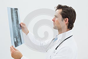 Concentrated male doctor examining spine xray