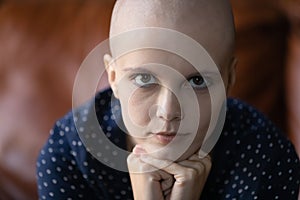 Concentrated woman having oncology gathering powers to struggle for life