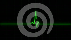 Concept 8-e1 realistic heart pulse monitor animation