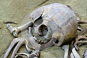 Concept archeology and scientific studies of death and exhumation. A close-up of the remains of a man, a destroyed skull and bones