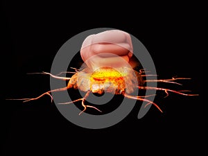 Concept as a heavy fist crushing and smashing cancer cells 3d Illustration