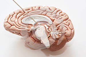 Concept of brain recording in subthalamic nucleus for Parkinson disease surgery