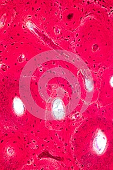 Concept of Education anatomy and physiology of Compact bone, or cortical bone under the microscopic.