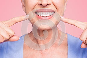 Concept of having strong healthy straight white perfect teeth at old age. Cropped portrait of beaming smile female