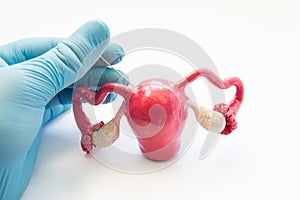 Concept photo of gynecological surgical procedure of biopsy female reproductive organs and tissues - uterine, endometrium or ovari photo