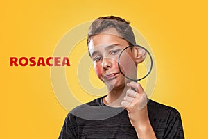 The concept of teenage acne. A teenage boy with a distressed face, holding a magnifying glass near his cheek with rosacea. Yellow