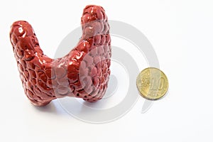 Concept of visualization of enlarged thyroid gland in various diseases, such as goiter, thyroiditis, nodule. Anatomical model of t