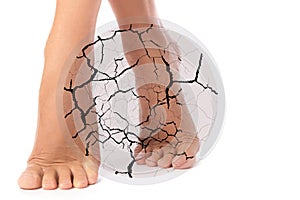 Concepts of cracked heel or other skin problems