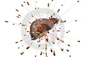 Conceptual image of drug-induced liver damage