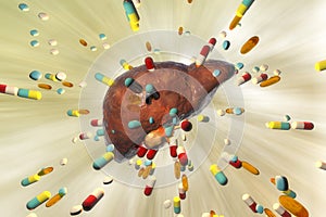 Conceptual image of drug-induced liver damage