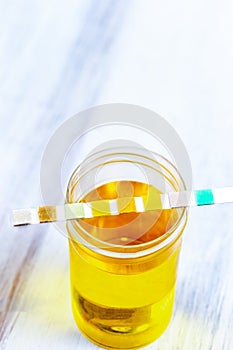 Conceptual image on urin alysis, dipstick placed on the vials of urine photo