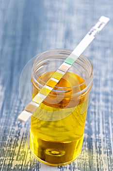 Conceptual image on urin alysis, dipstick placed on the vials of urine photo