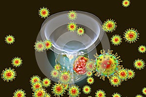 Conceptual image for viral ethiology of prostate cancer