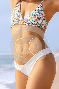 Conceptual tummy tuck incision contour lines on female torso