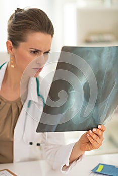 Concerned doctor woman looking on fluorography photo