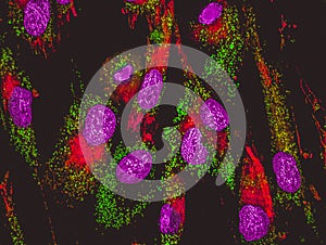 Confocal image of mitochondria staining photo