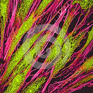 Confocal microscopy of fibroblast cells