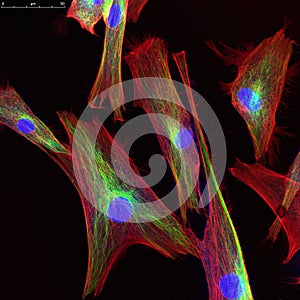 Confocal microscopy of fibroblast cells
