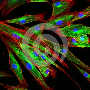 Confocal microscopy of fibroblast cells